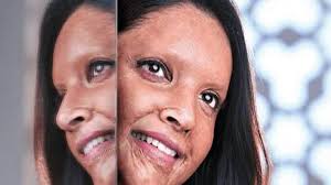 Chhapaak