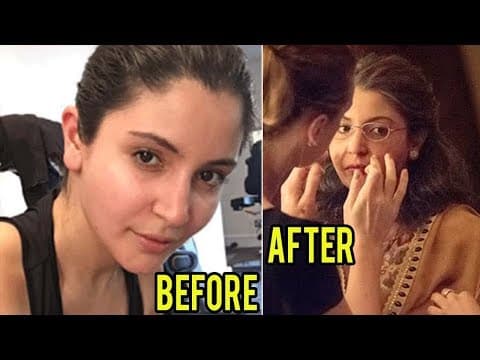 Anushka Sharma UNBELIEVABLE Old Woman Look