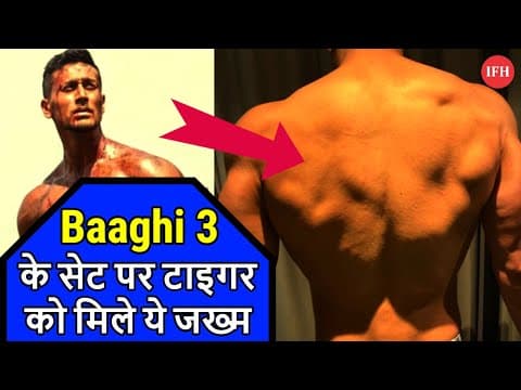 Is Tiger Shroff Injured On Baaghi 3 Set ? | IFH