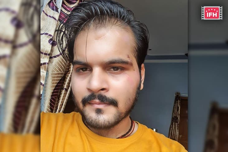 Arvind Akela Kallu Suffers Face Injuries While Shooting For Race