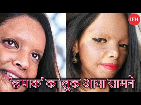 "Chhapaak" A New Pic Of Deepika Padukone From Film Set Goes Viral