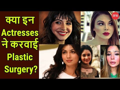 क्या इन Actresses ने करवाई है Lips की Plastic Surgery
